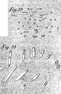 Zeichnungen von Robert Koch und Ferdinand Julius Cohn zur Keimung von Milzbrandsporen mit Optiken von Hartnack bzw. Seibert Ausschnitt aus Tafel XI, Robert Koch: Untersuchung über Bacterien, V. Die Aetiologie der Milzbrand-Krankheit, begründet auf die Entwicklungsgeschichte des Bacillus Anthracis von Dr. Koch, Kreisphysikus in Wollstein (Ferdinand Julius Cohn [Herausgeber]: Beiträge zur Biologie 